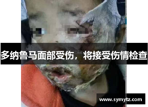 多纳鲁马面部受伤，将接受伤情检查